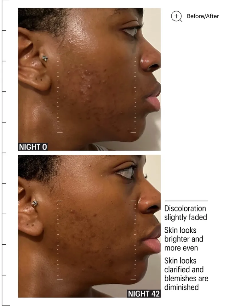 allies_of_skin_mandelic_p_7.webp Allies of Skin Mandelic Pigmentation Corrector Night Serum | MECCA Online