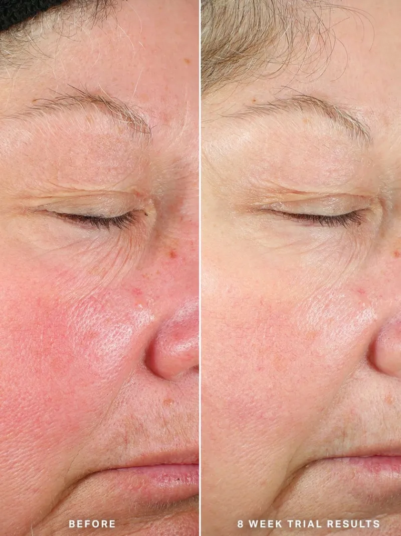 alphah_generation_glow_da_6.webp Alpha-H Generation Glow Daily Resurfacing Essence | MECCA Fashion