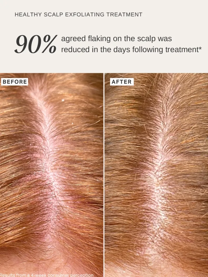 alphah_healthy_exfoliatin_2.webp Alpha-H Healthy Exfoliating Scalp Treatment | MECCA Hot