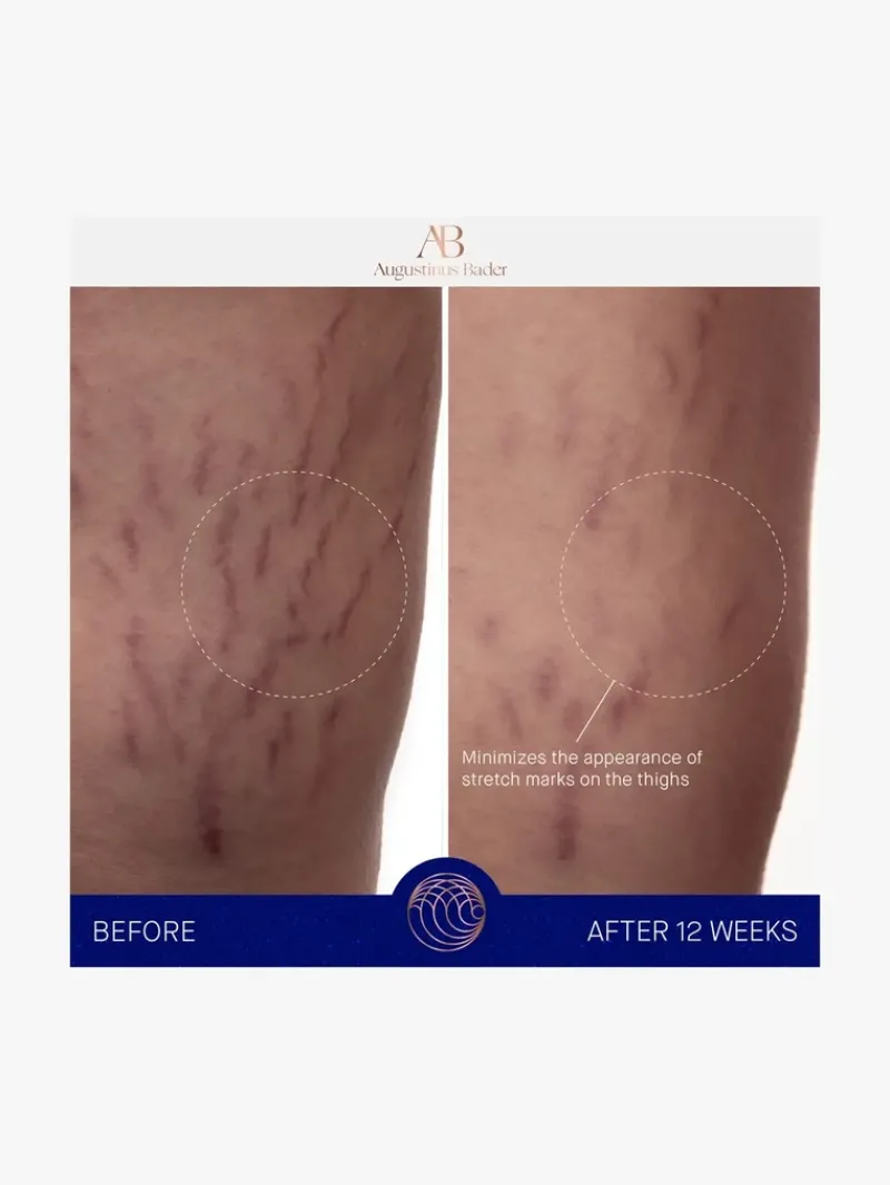 augustinus_bader_the_body_3.webp Augustinus Bader The Body Cream | MECCA Best
