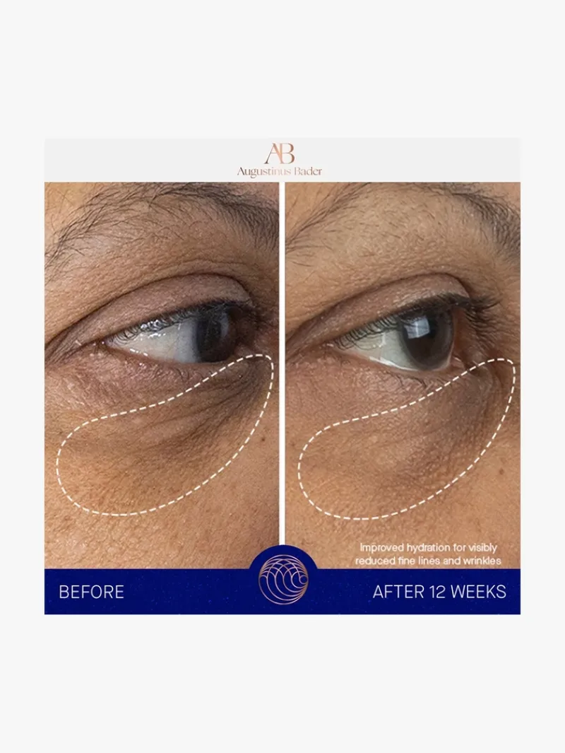 augustinus_bader_the_eye__10.webp Augustinus Bader The Eye Cream Nomad | MECCA Best