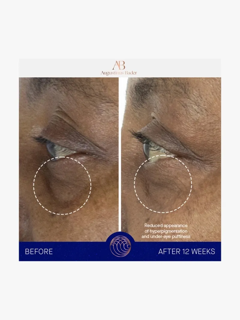 augustinus_bader_the_eye__9.webp Augustinus Bader The Eye Cream Nomad | MECCA Best