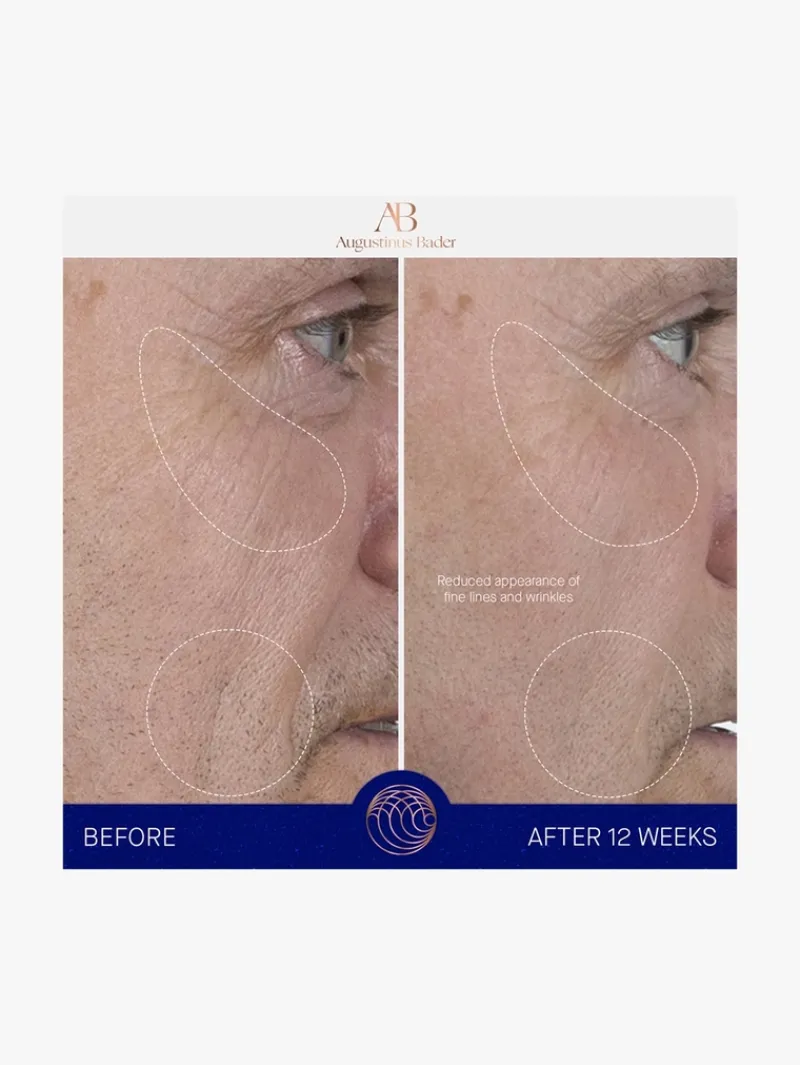 augustinus_bader_the_seru_9-1.webp Augustinus Bader The Serum Nomad | MECCA New