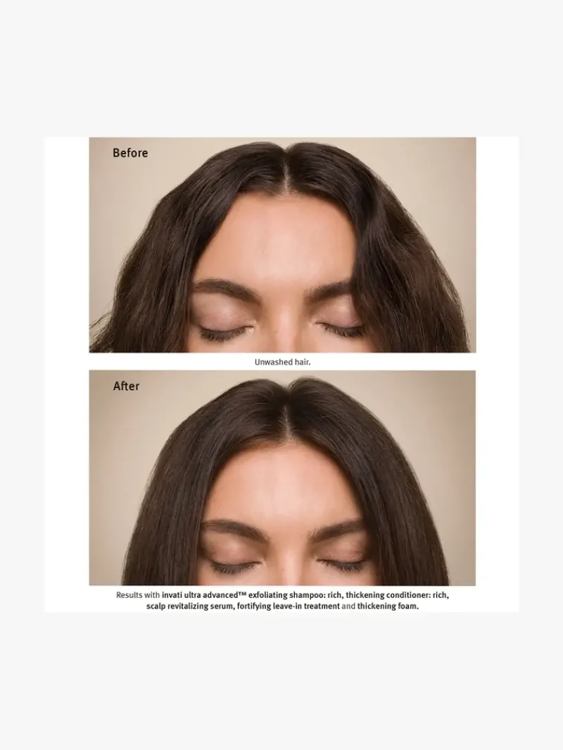 aveda_invati_ultra_advanc_2-3.webp AVEDA Invati Ultra Advanced™ Light System Set | MECCA Discount