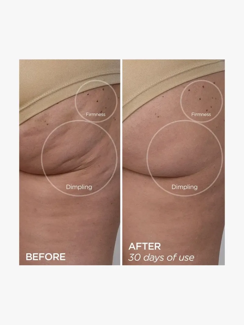 beautybio_glopro_body_mic_3.webp BeautyBio GloPro® Body MicroTip™ Attachment | MECCA Outlet