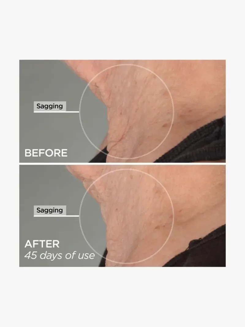 beautybio_r_the_lift_adva_8.webp BeautyBio R45 The Lift Advanced Neck Contouring Treatment | MECCA Discount