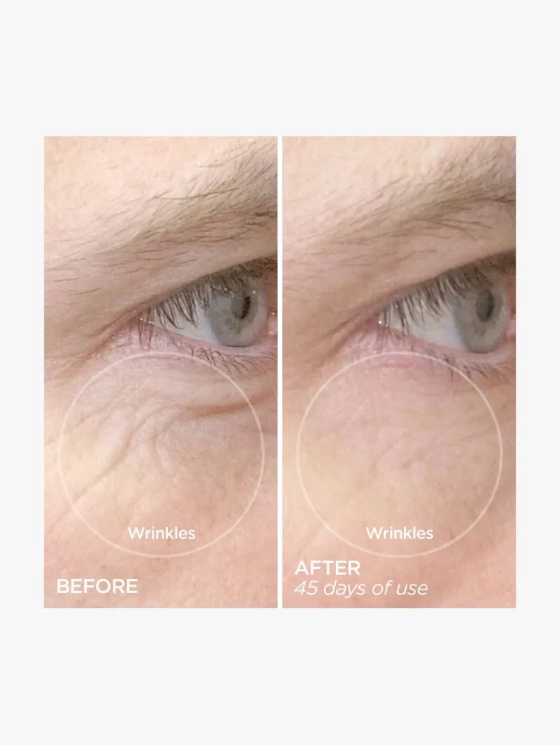 beautybio_r_the_reversal__9.webp BeautyBio R45 The Reversal 3-Phase Retinol Booster System | MECCA New