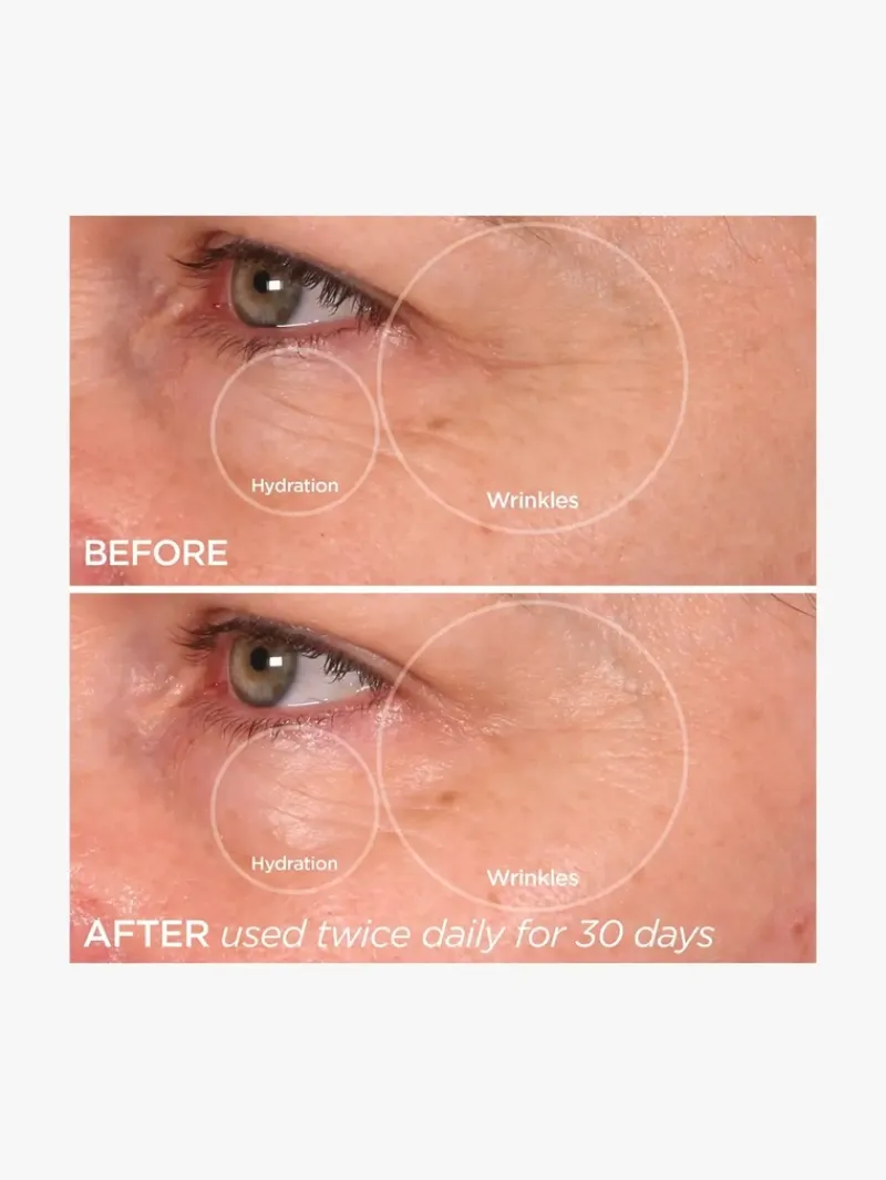 beautybio_the_quench_eye__7.webp BeautyBio The Quench Eye | MECCA Hot