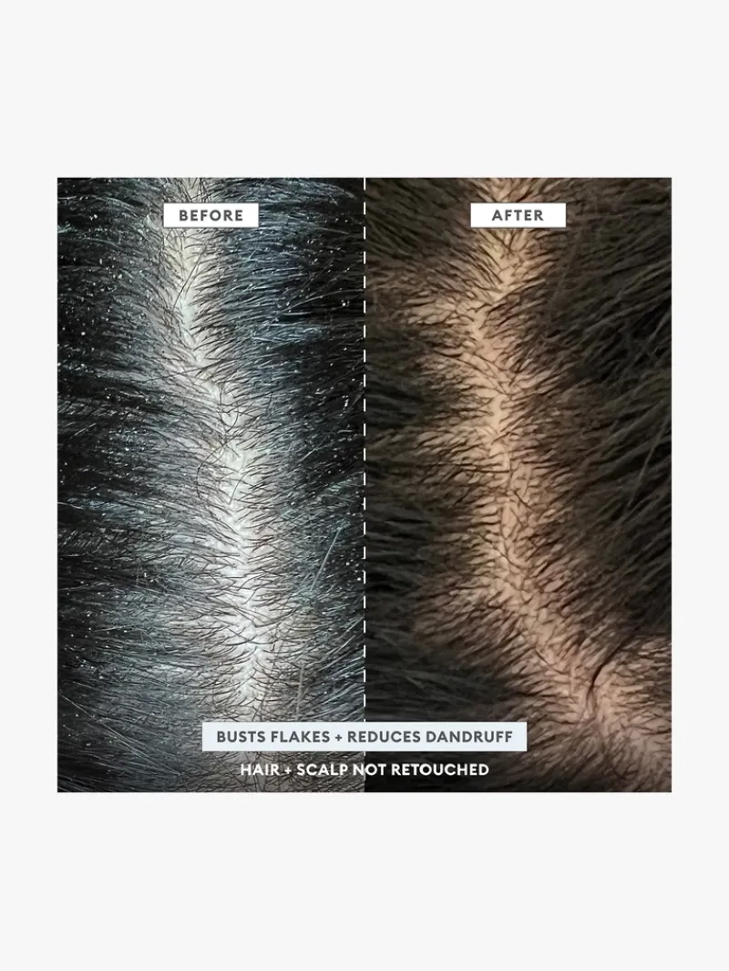 briogeo_scalp_revival_aha_2.webp Briogeo Scalp Revival AHA BHA Shampoo | MECCA New