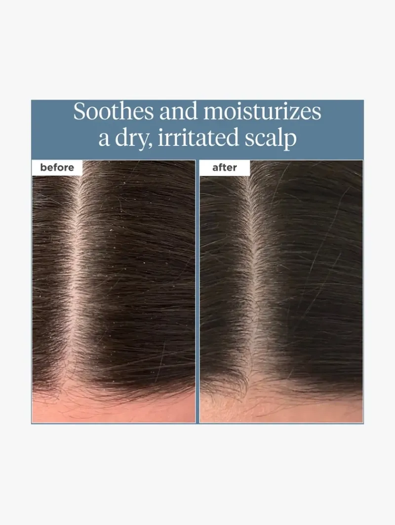 briogeo_scalp_revival_ros_2.webp Briogeo Scalp Revival™ Rosemary Pre-Wash Oil for Hair and Scalp 100ml | MECCA Hot