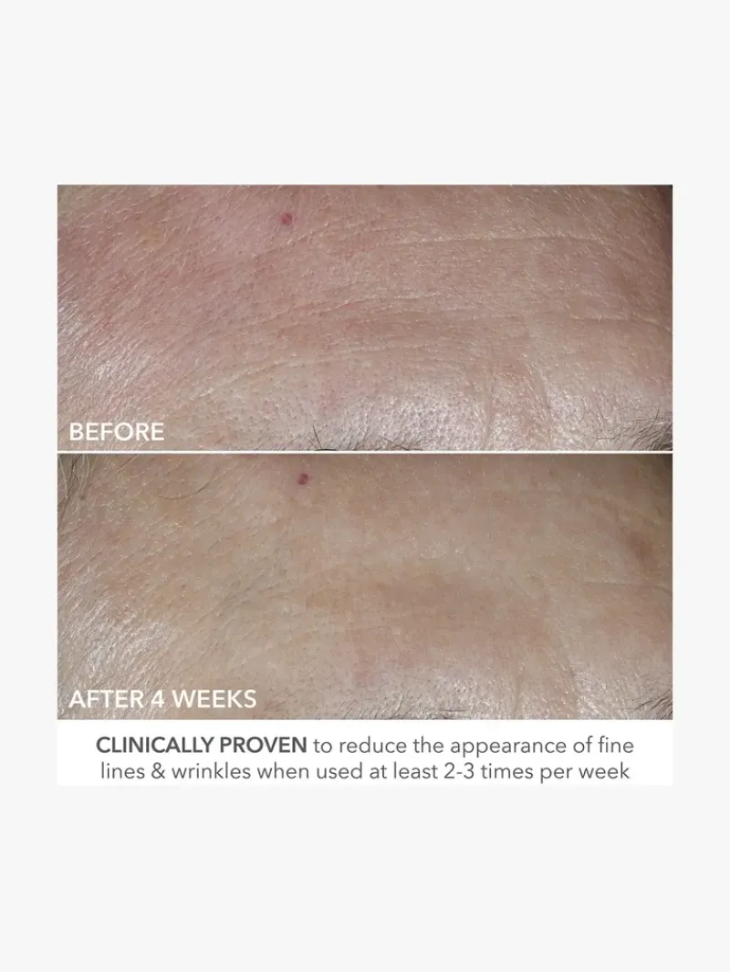 dr_dennis_gross_advanced__8-1.webp Dr. Dennis Gross Advanced Retinol + Ferulic Perfectly Dosed Retinol Universal 0.2% | MECCA Best