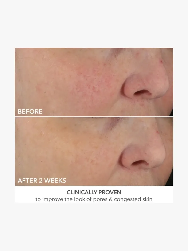 dr_dennis_gross_advanced__9-1.webp Dr. Dennis Gross Advanced Retinol + Ferulic Perfectly Dosed Retinol Universal 0.2% | MECCA Best
