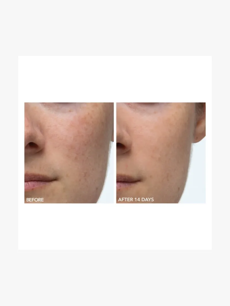 Dr. Dennis Gross Dr Dennis Gross Alpha Beta Extra Strength Daily Peel 30 App | MECCA Sale
