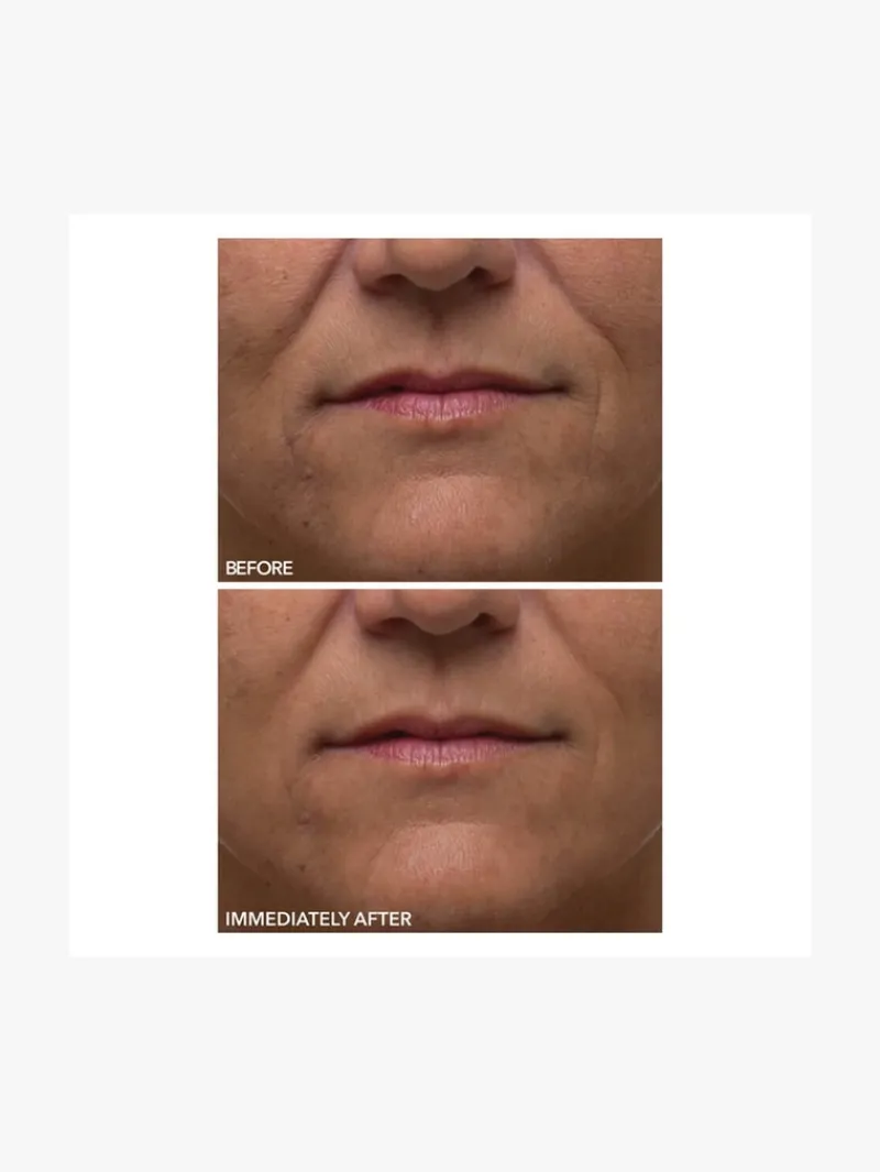 Dr. Dennis Gross Dr Dennis Gross Alpha Beta Ultra Gentle Peel | MECCA Fashion