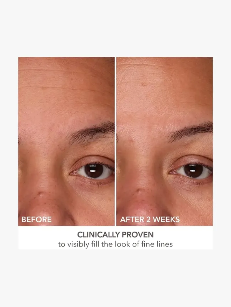 dr_dennis_gross_derminfus_11.webp Dr. Dennis Gross DermInfusions 3D Visible Fill + Repair Serum | MECCA Fashion
