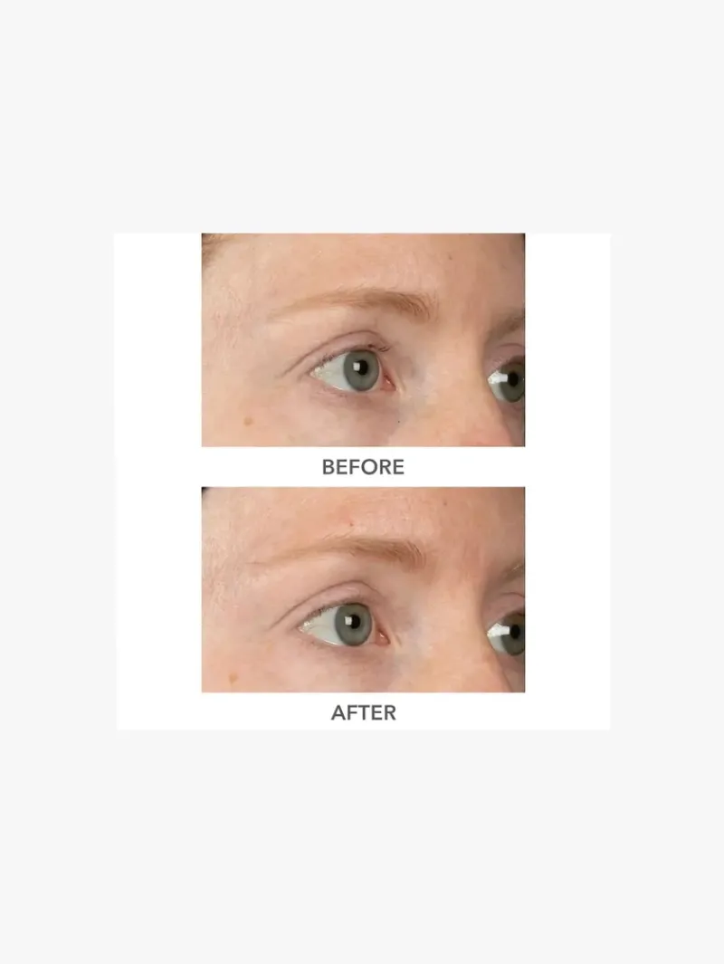 dr_dennis_gross_derminfus_5-2.webp Dr. Dennis Gross DermInfusions 3D Plump, Fill and Repair | MECCA Clearance