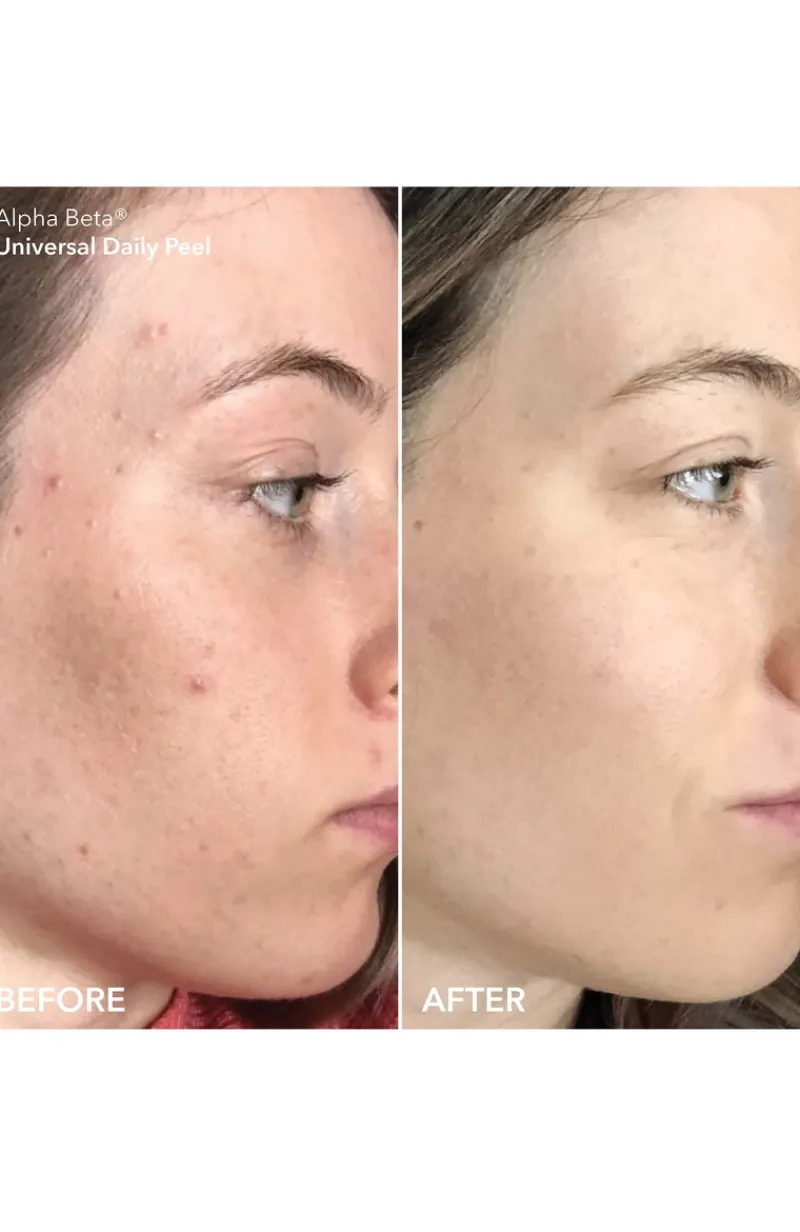 dr_dennis_gross_hyaluroni_4.webp Dr. Dennis Gross Hyaluronic Acid Heroes | MECCA Online