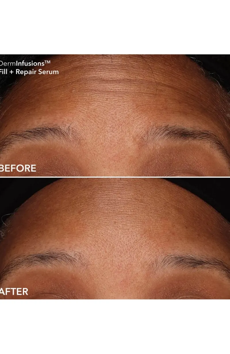 dr_dennis_gross_hyaluroni_5.webp Dr. Dennis Gross Hyaluronic Acid Heroes | MECCA Online