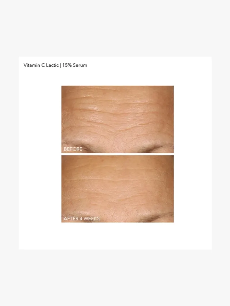 dr_dennis_gross_vitamin_c_6.webp Dr. Dennis Gross Dr Dennis Gross Vitamin C+Lactic 15% Vitamin C Firm & Bright Serum | MECCA Hot