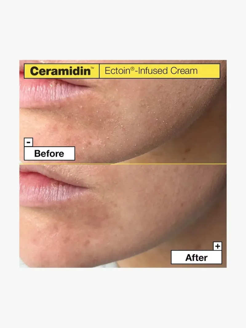 dr_jart_ceramidin_ectoini_3.webp Dr. Jart+ Ceramidin Ectoin-Infused Cream | MECCA Hot