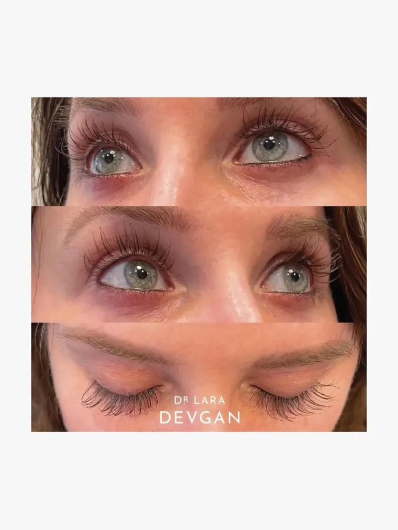 dr_lara_devgan_platinum_l_7-1.webp Dr. Lara Devgan Platinum Long Lash | MECCA Discount