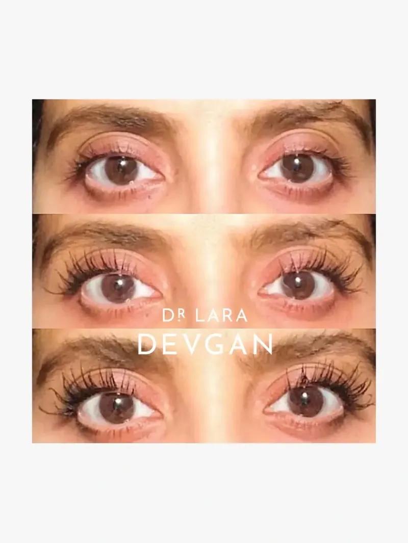 dr_lara_devgan_platinum_l_8.webp Dr. Lara Devgan Platinum Long Lash | MECCA Discount