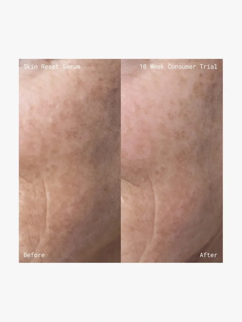 emma_lewisham_skin_reset__6.webp Emma Lewisham Skin Reset Serum Refill | MECCA New