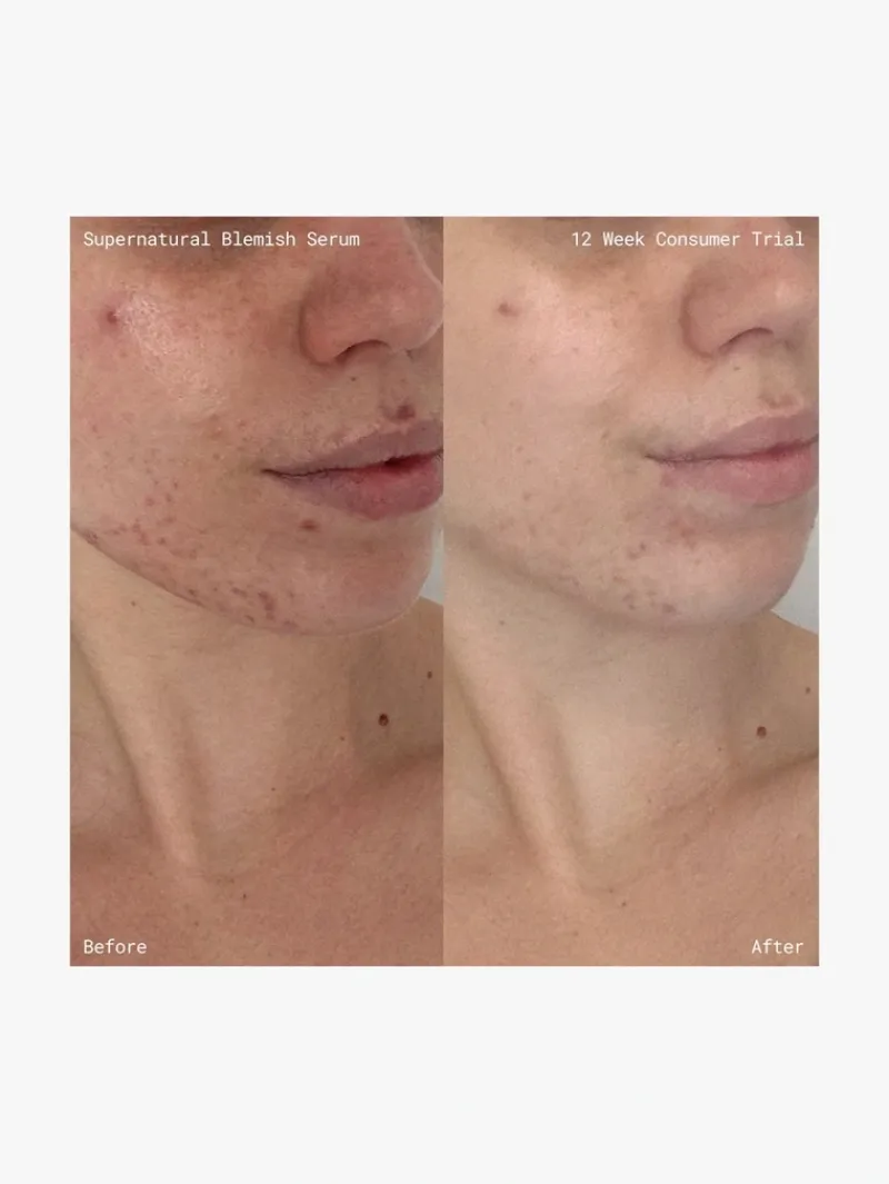emma_lewisham_supernatura_5.webp Emma Lewisham Supernatural Blemish Face Serum | MECCA Online