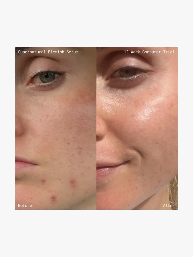 emma_lewisham_supernatura_6.webp Emma Lewisham Supernatural Blemish Face Serum | MECCA Online