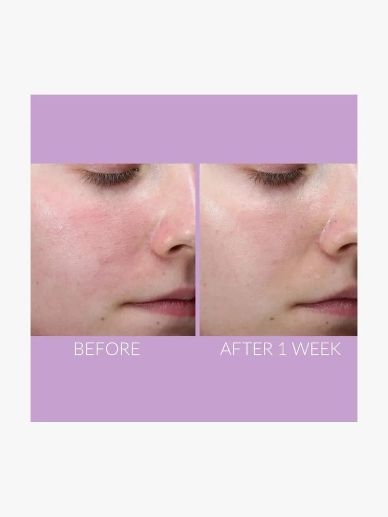 kate_somerville_delikate__3.webp Kate Somerville DeliKate® Recovery Serum | MECCA Hot