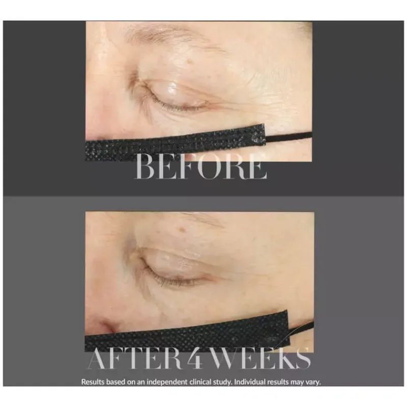 kate_somerville_lifting_e_3.webp Kate Somerville Lifting Eye Cream - KateCeuticals | MECCA Fashion
