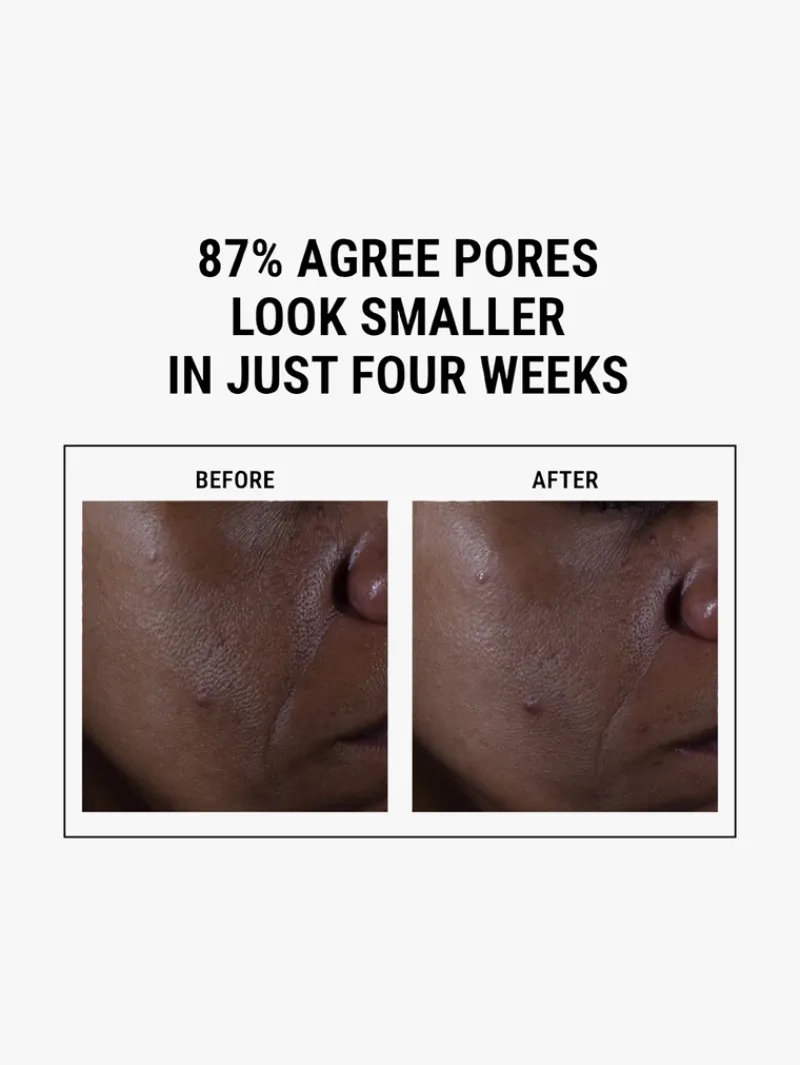 kiehlxs_ultra_pure_highpo_6.webp Kiehl's Kiehl's Ultra Pure High-Potency 9.8% Glycolic Acid Serum | MECCA Best