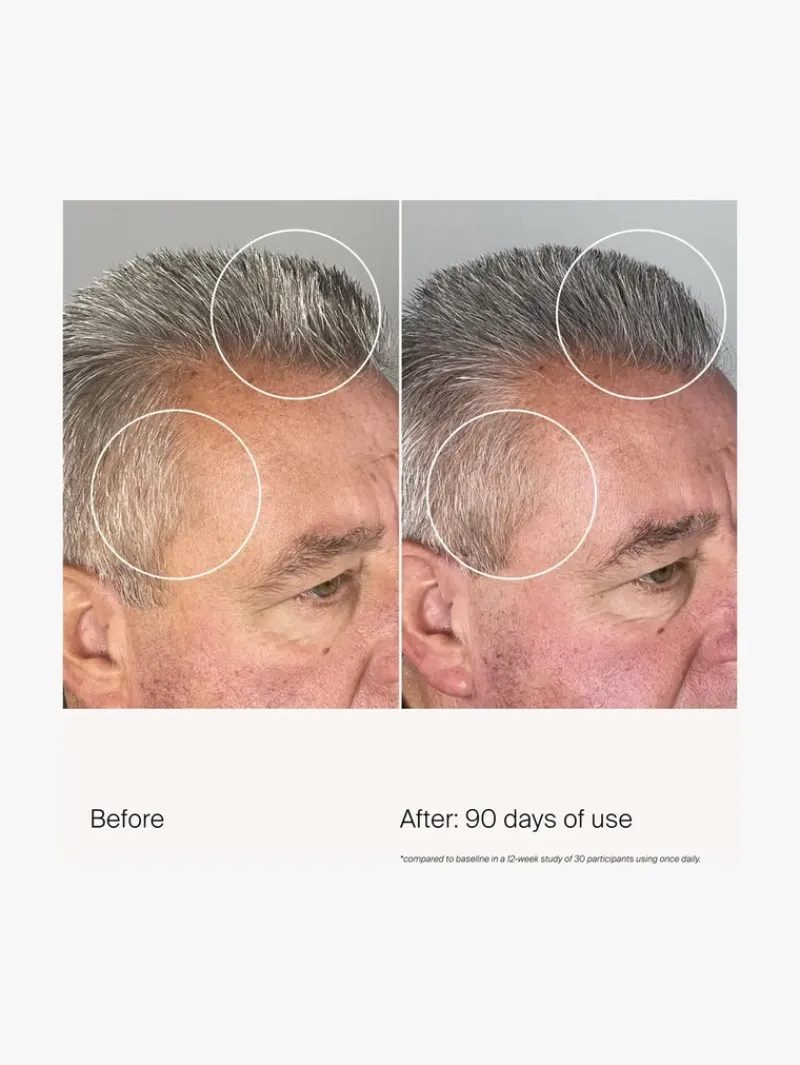 living_proof_scalp_care_d_7.webp Living Proof Scalp Care Density Serum | MECCA Outlet