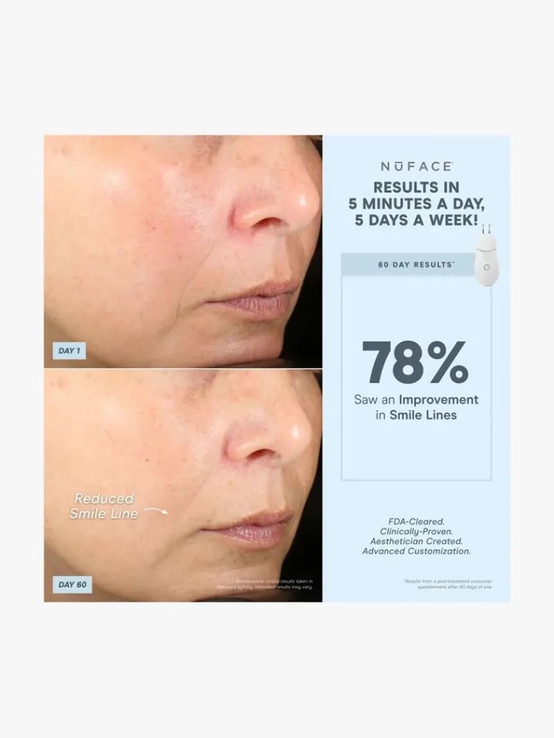 nuface_effective_lip_amp__7.webp NuFACE Effective Lip & Eye Attachment | MECCA Discount