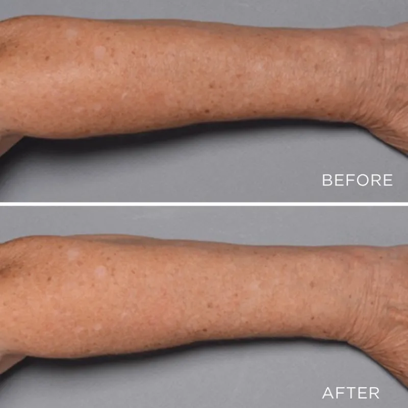 perricone_md_cold_plasma__4-3.webp Perricone MD Cold Plasma Plus+ Fragile Skin Therapy | MECCA Fashion
