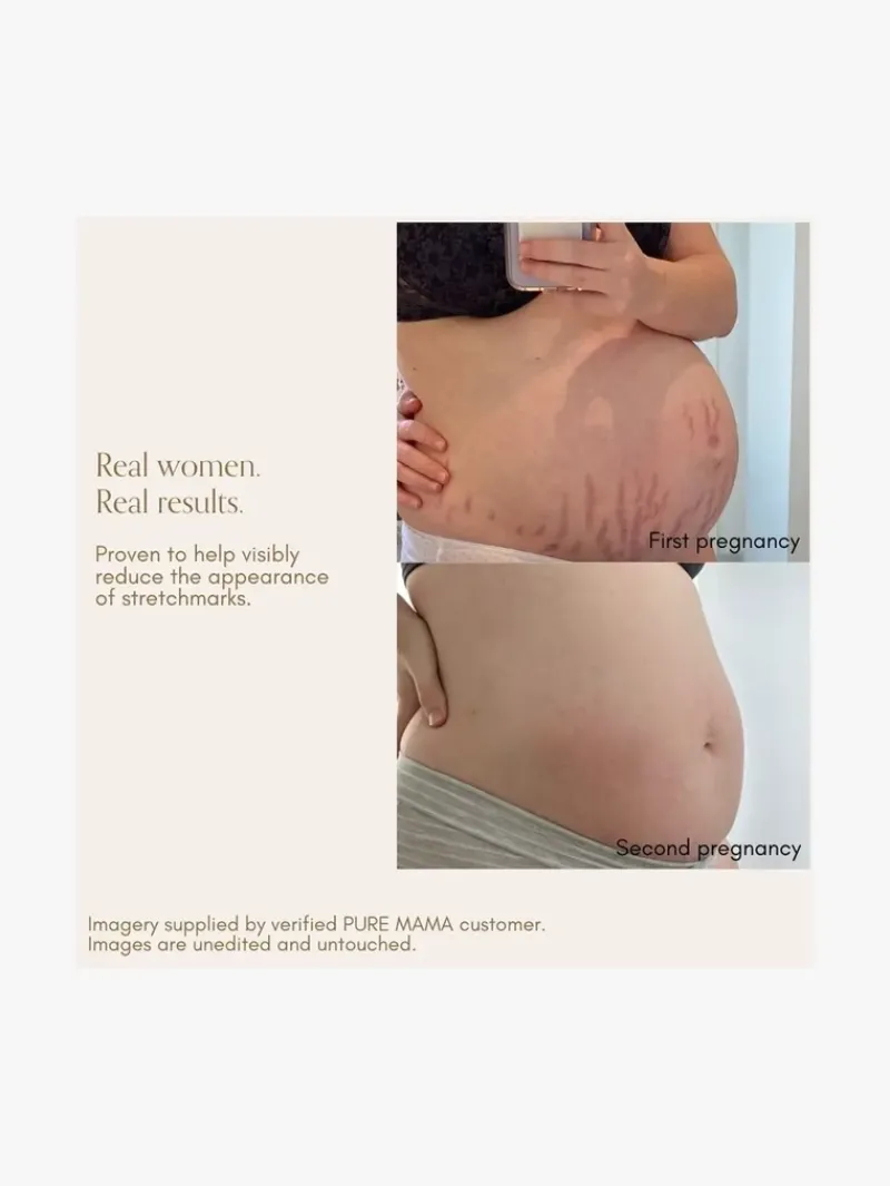 pure_mama_belly_oil__mecc_2.webp Pure Mama Belly Oil | MECCA Online
