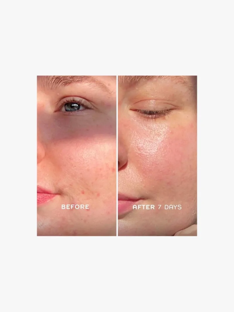 REN Clean Skincare Evercalm Repair Complex | MECCA Outlet
