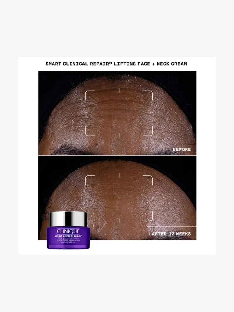 shop_smart_clinical_repai_2.webp Clinique Shop Smart Clinical Repair Lifting Face + Neck Cream - | MECCA Sale